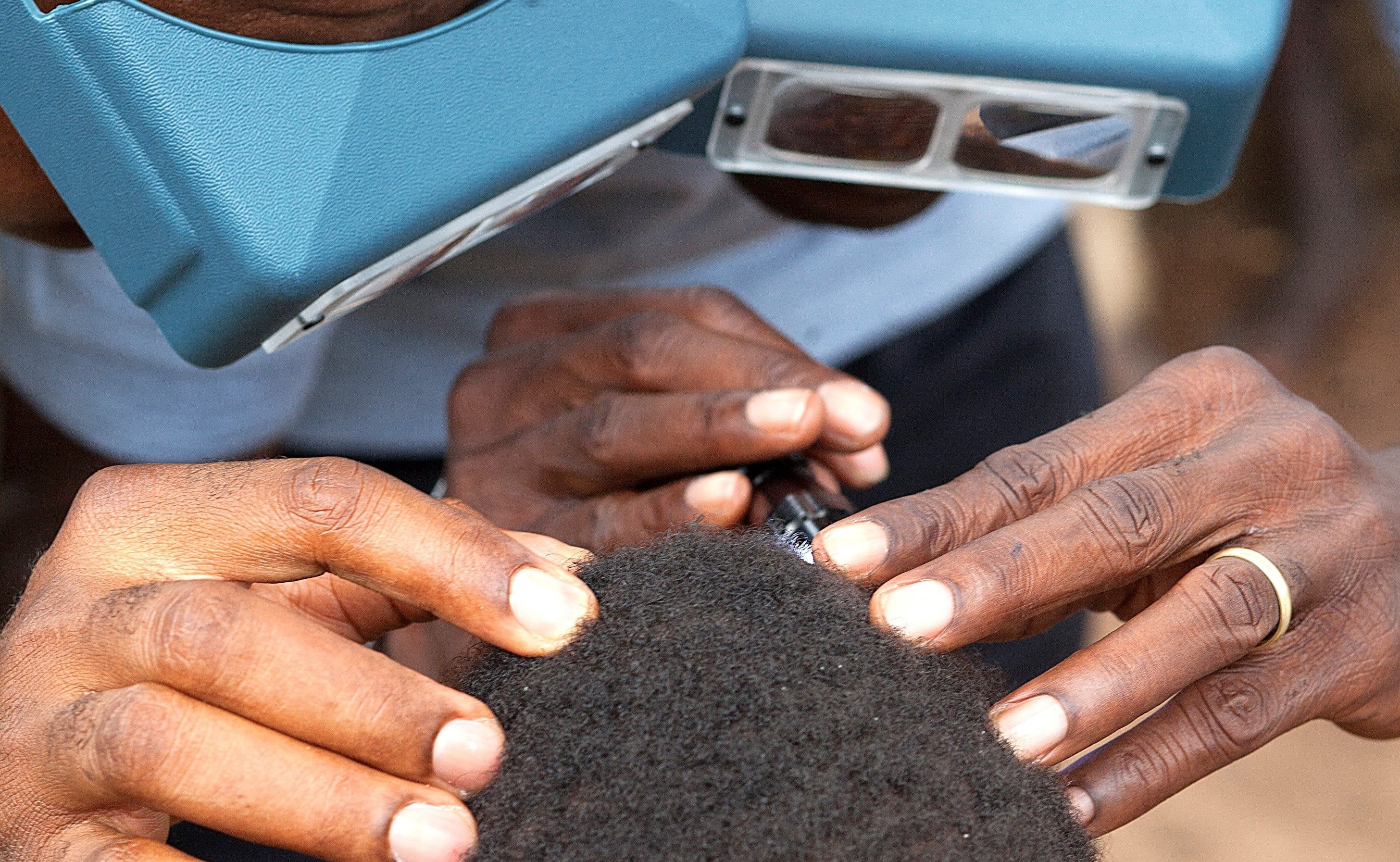Examination-crop Two graders conferring during eye examination, Togo, 2017, illustrating the level of rigor applied to establishing the prevalence of trachoma nationally.